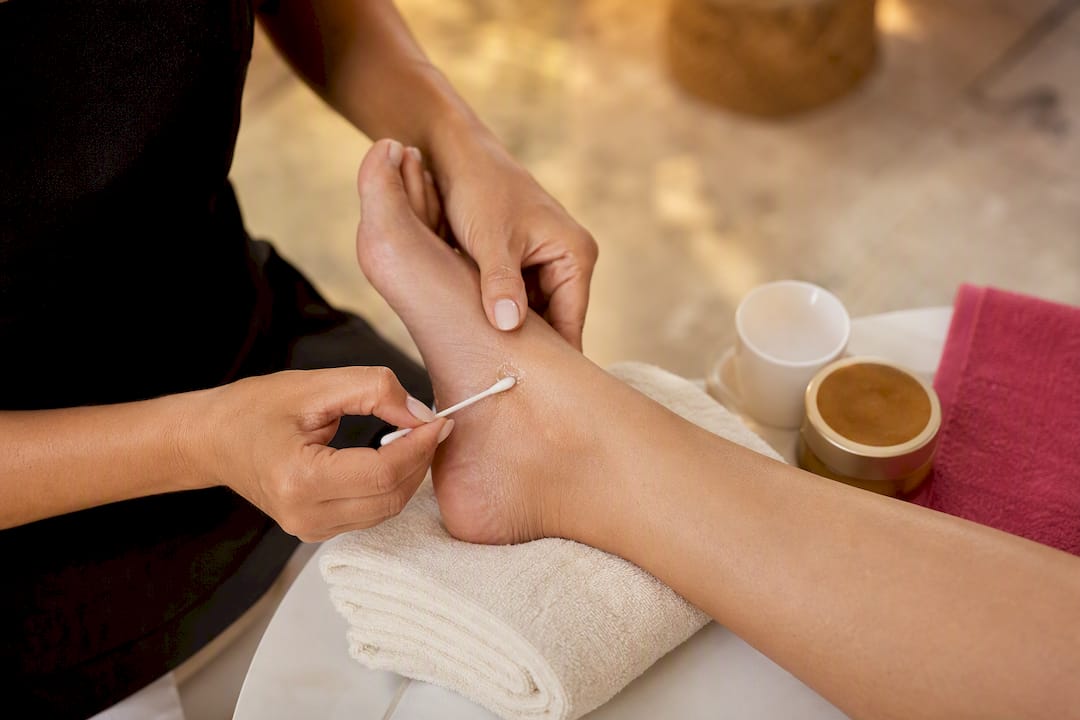 Technician performing ankle patch test